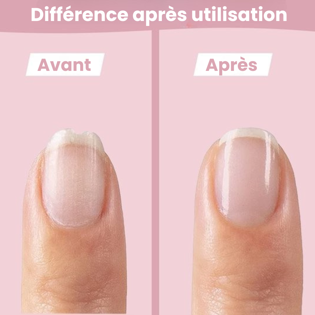 SafeCare – Silencieux et sûr – Set de limes à ongles électriques pour bébés
